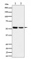 AAMP Antibody
